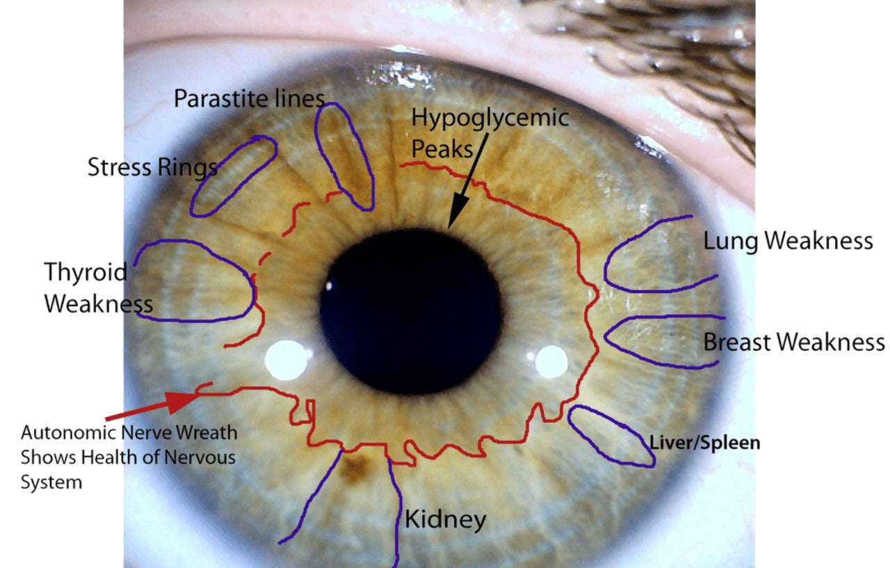 Iridology Assessment Consultation with supportive Phyto-Medicine (herbal) protocol.
