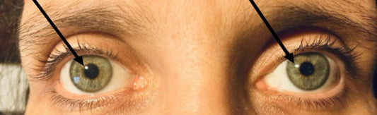 Virtual Iridology Assessment & Herbal Wellness Report